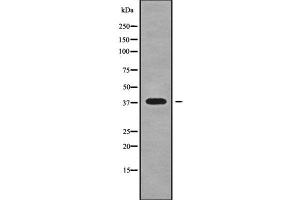 Western blot analysis NKX23 using RAW264. (NK2 Homeobox 3 antibody  (Internal Region))