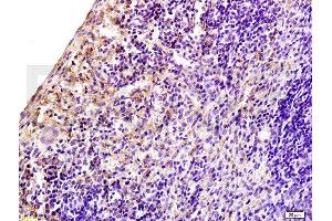 Formalin-fixed and paraffin embedded rat spleen tissue labeled with Anti-CD97 Polyclonal Antibody, Unconjugated at 1:200 followed by conjugation to the secondary antibody, (SP-0023), and DAB staining (CD97 antibody  (AA 741-835))