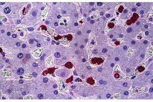 Human Liver: Formalin-Fixed, Paraffin-Embedded (FFPE) (HGS antibody  (AA 451-500))
