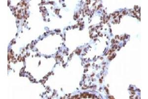 IHC testing of FFPE rat lung with Nuclear Antigen antibody. (Nuclear Antigen antibody)