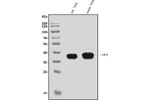 Western blot analysis of Podoplanin/gp36/Pdpn using anti-Podoplanin/gp36/Pdpn antibody (ABIN7600811).