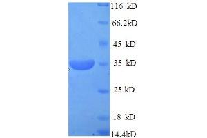 SDS-PAGE (SDS) image for Pituitary Homeobox 3 (PITX3) (AA 1-302), (full length) protein (His tag) (ABIN5713730) (PITX3 Protein (AA 1-302, full length) (His tag))