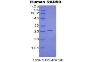 SDS-PAGE analysis of Human RAD50 Protein. (RAD50 Protein)
