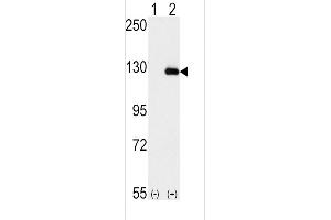 Western blot analysis of BUB1B (arrow) using rabbit polyclonal BUB1B Antibody (N-term) (ABIN392627 and ABIN2842137).