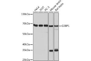 Western blot analysis of extracts of various cell lines, using G3BP11 Rabbit mAb (ABIN1683144, ABIN7101598, ABIN7101599 and ABIN7101600) at 1:1000 dilution. (G3BP1 antibody)
