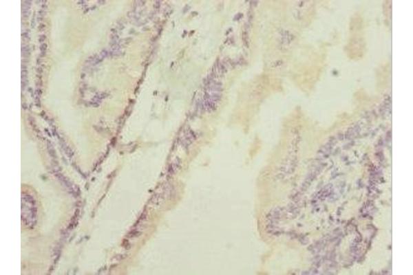 HAND2 antibody  (AA 1-217)