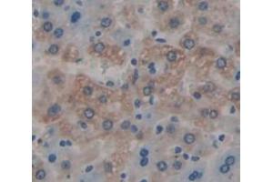 Figure. (IRS3 antibody  (AA 1-110))