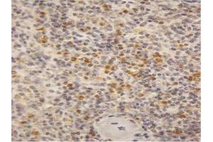 AP23688PU-N (2µg/ml) staining of paraffin embedded Human Spleen. (CYBB antibody  (Internal Region))