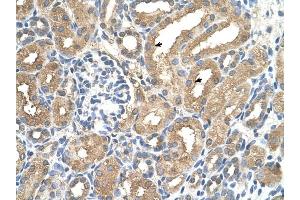 ADAMTS4 antibody was used for immunohistochemistry at a concentration of 4-8 ug/ml to stain Epithelial cells of renal tubule (arrows) in Human Kidney. (ADAMTS4 antibody  (N-Term))