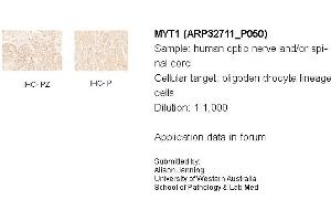 Sample Type: Human Optic Nerve and Spinal CordCellular Target: Oligoden Drocyte Lineage cellsDilution: 1:1000 (MYT1 antibody  (N-Term))