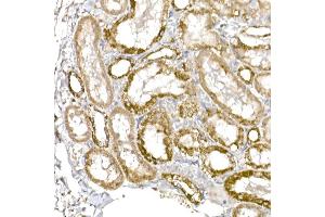 Immunohistochemistry (IHC) image for anti-Complement Component 1, Q Subcomponent Binding Protein (C1QBP) antibody (ABIN7266473)
