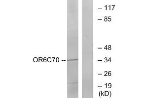 Western blot analysis of extracts from Jurkat cells, using OR6C70 antibody.