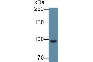 Western blot analysis of Mouse Blood Cells lysate, using Mouse CFB Antibody (2 µg/ml) and HRP-conjugated Goat Anti-Rabbit antibody ( (Complement Factor B antibody  (AA 474-590))
