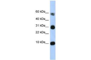 WB Suggested Anti-FABP4 Antibody Titration:  0. (FABP4 antibody  (Middle Region))