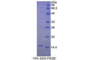 SDS-PAGE (SDS) image for Transforming Growth Factor, beta 2 (TGFB2) (AA 331-442) protein (His tag) (ABIN2122250)