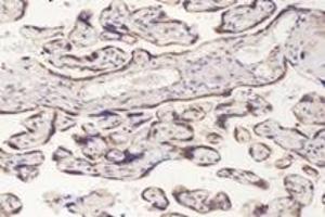 Immunohistochemistry analysis of paraffin-embedded human placenta using,PFDN4 (ABIN7075171) at dilution of 1: 4200 (PFDN4 antibody)
