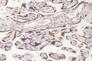 Immunohistochemistry analysis of paraffin-embedded human placenta using,PFDN4 (ABIN7075171) at dilution of 1: 4200