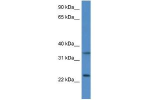 WB Suggested Anti-Cyb5r1 Antibody   Titration: 1. (CYB5R1 antibody  (N-Term))