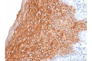 Formalin-fixed, paraffin-embedded human Skin stained with Cytokeratin 16 Rabbit Recombinant Monoclonal Antibody (KRT16/2043R). (Recombinant KRT16 antibody  (C-Term))