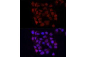 Immunofluorescence (IF) image for anti-Yes-Associated Protein 1 (YAP1) antibody (ABIN1683302)