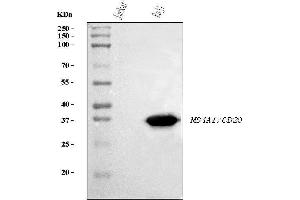 Western blot analysis of CD20 using anti-CD20 antibody (ABIN7599180). (CD20 antibody  (AA 1-261))