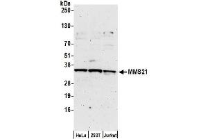 anti-E3 SUMO-Protein Ligase NSE2 (NSMCE2) (AA 1-50) antibody