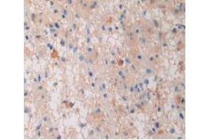 Figure. (PZP antibody  (AA 1212-1391))