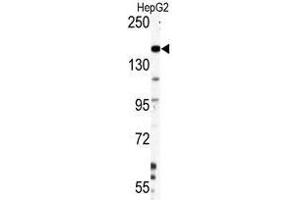 Image no. 1 for anti-Nestin (NES) antibody (ABIN357404)