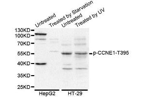Western blot analysis of extracts of various cell lines, using Phospho-CCNE1-T395 antibody (ABIN5969875). (Cyclin E1 antibody  (pThr395))