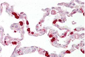 Immunohistochemistry with Lung tissue at an antibody concentration of 5µg/ml using anti-GSTT1 antibody (ARP48490_P050) (GSTT1 antibody  (C-Term))