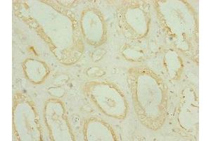 Immunohistochemistry of paraffin-embedded human kidney tissue using ABIN7159686 at dilution of 1:100 (CHCHD3 antibody  (AA 1-227))