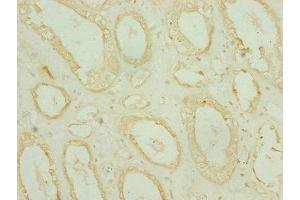 Immunohistochemistry of paraffin-embedded human kidney tissue using ABIN7159686 at dilution of 1:100 (CHCHD3 antibody  (AA 1-227))