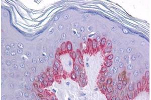 Human Skin: Formalin-Fixed, Paraffin-Embedded (FFPE) (ZC3H12C antibody  (N-Term))