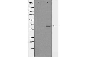 Western blot analysis of Cyclin E2 expression in COLO cells. (Cyclin E2 antibody  (C-Term))