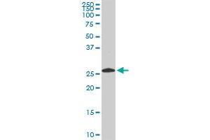 PSMA8 monoclonal antibody (M03A), clone 2E3. (PSMA8 antibody  (AA 143-242))