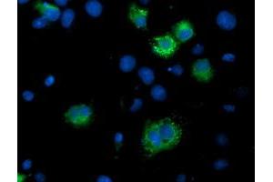 Immunofluorescence (IF) image for anti-IlvB (Bacterial Acetolactate Synthase)-Like (ILVBL) antibody (ABIN1498879)