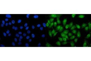 IF analysis of RTCD1/RTCA using anti-RTCD1/RTCA antibody (ABIN7600334). (RTCD1 antibody  (AA 18-366))