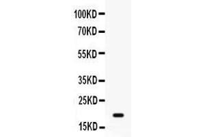 Western blot analysis of GADD45A expression in MCF-7 whole cell lysates ( Lane 1). (GADD45A antibody  (C-Term))