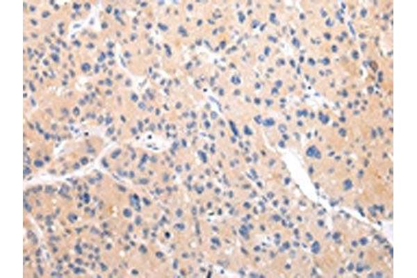 ZNF16 antibody