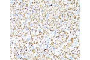 Immunohistochemistry of paraffin-embedded Rat ovary using CYP3A4 Polyclonal Antibody at dilution of 1:100 (40x lens).