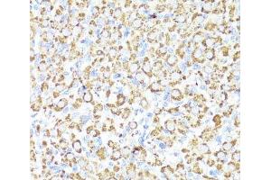 Immunohistochemistry of paraffin-embedded Rat ovary using CYP3A4 Polyclonal Antibody at dilution of 1:100 (40x lens). (CYP3A4 antibody)