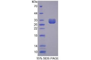 SDS-PAGE analysis of Human CLCA1 Protein. (CLCA1 Protein)