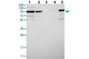 Western blot analysis of Lane 1: RT-4, Lane 2: U-251 MG, Lane 3: Human Plasma, Lane 4: Liver, Lane 5: Tonsil with LRCH1 polyclonal antibody  at 1:250-1:500 dilution.