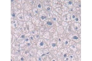 IHC-P analysis of Human Tissue, with DAB staining. (Integrin beta 4 antibody  (AA 923-1197))