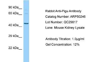 Western Blotting (WB) image for anti-Phosphatidylinositol Glycan Anchor Biosynthesis, Class U (PIGU) (N-Term) antibody (ABIN2784115) (PIGU antibody  (N-Term))