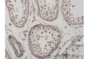 Image no. 3 for anti-Interferon Regulatory Factor 5 (IRF5) antibody (ABIN6745988) (IRF5 antibody)