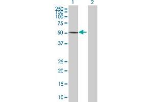 Western Blot analysis of CALCOCO2 expression in transfected 293T cell line by CALCOCO2 MaxPab polyclonal antibody. (CALCOCO2 antibody  (AA 1-446))
