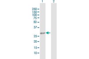 Western Blot analysis of AK2 expression in transfected 293T cell line by AK2 MaxPab polyclonal antibody. (Adenylate Kinase 2 antibody  (AA 1-239))