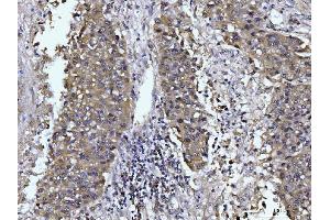 IHC analysis of Glutaminase/GLS using anti-Glutaminase/GLS antibody (ABIN7601601). (Glutaminase antibody  (AA 396-654))