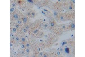 Figure. (CUTA antibody  (AA 33-179))